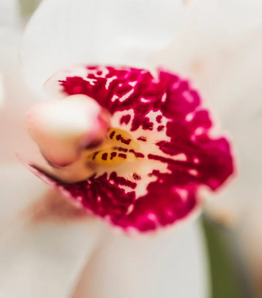Relleno de labios mayores