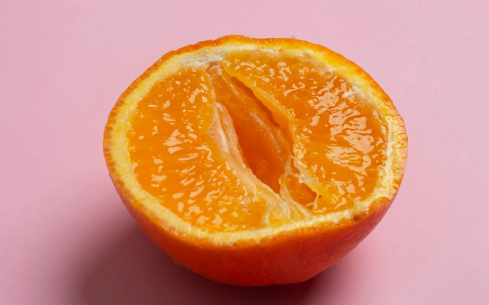Liposucción monte de venus + lipofilling de labios mayores